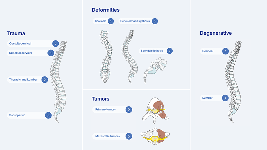 Spine